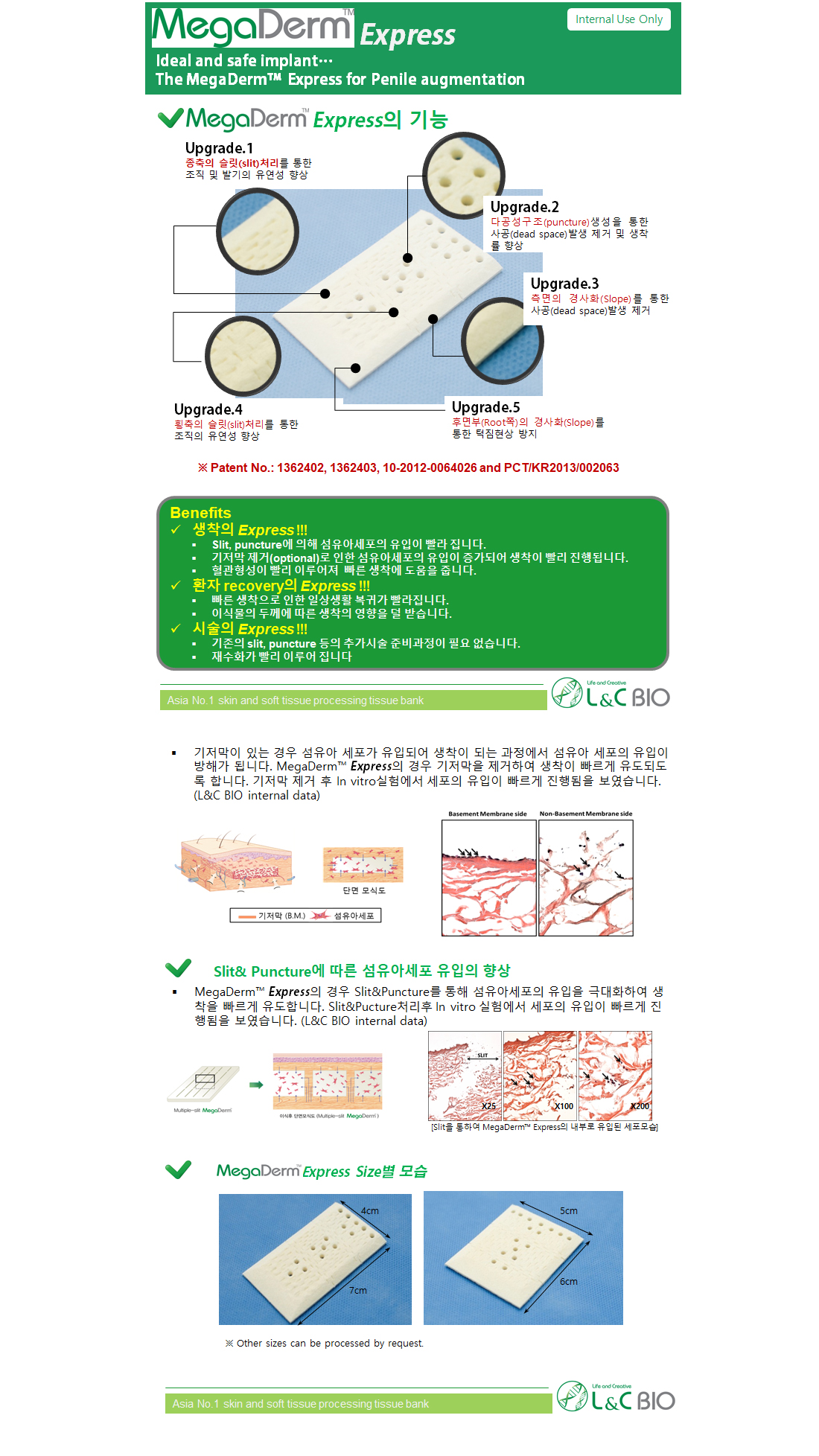 메가덤제품기설명